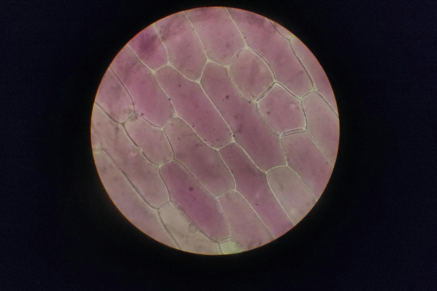 Фибриноген: норма, причины повышения и снижения