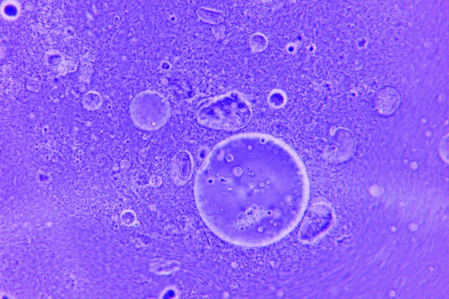 IgG, IgM, IgA: разбор иммуноглобулинов