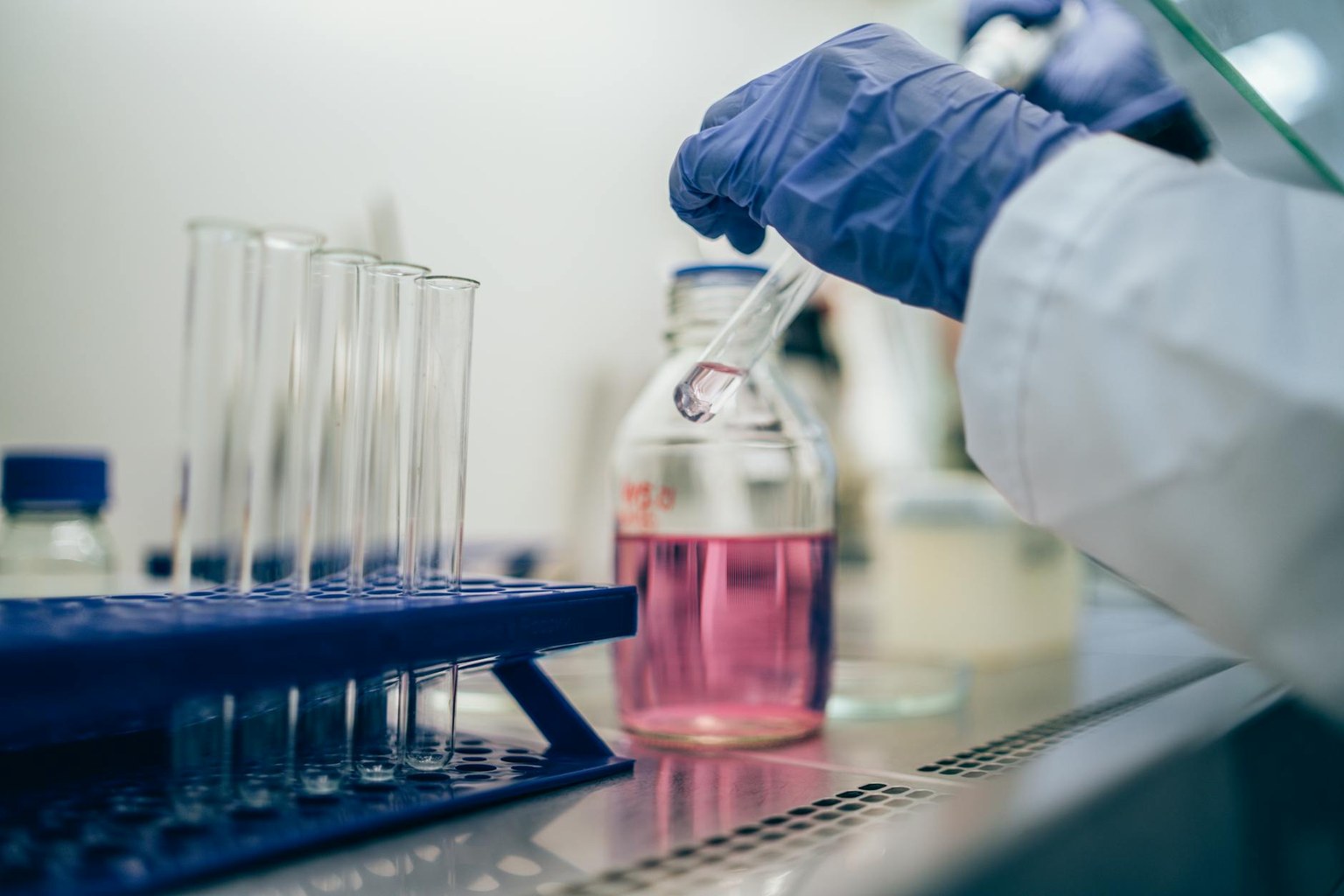 Печёночные пробы: полная расшифровка в одной таблице