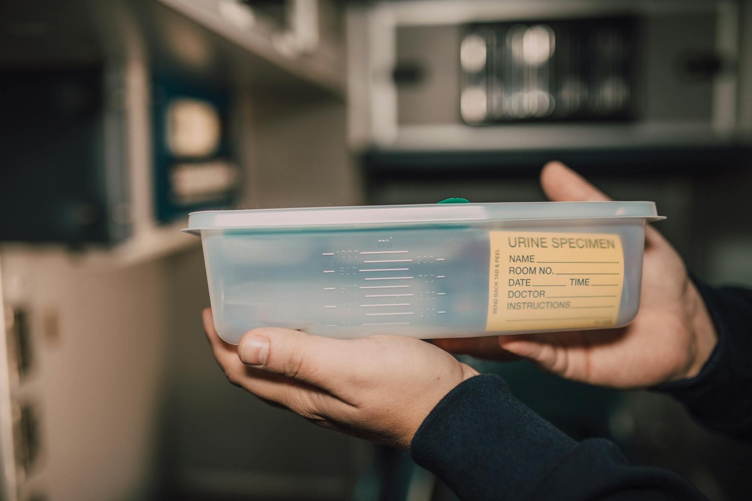 Соли в моче: оксалаты, ураты, фосфаты — когда волноваться